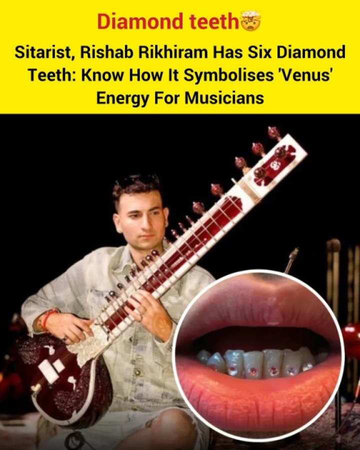 Your views