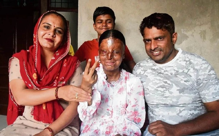 17-year-old Kafi, an acid attack survivor in Chandigarh, has topped her school in the Class 12 board exams with an impressive 95.6%.