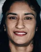 Vinesh Phogat