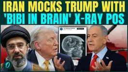 Trump BOMBING Iran on Netanyahu’s ORDER? Iran MOCKS Trump With Humiliating ‘BIBI IN BRAIN’ Photo