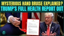 Trump PUBLICLY Post Full Health Reports; Mysterious Bruise on Hand Revealed Ahead of Mid Terms