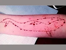 Blue Whale Game Pondicherry University Student Commits Suicide By Hanging Himself 2534175.html