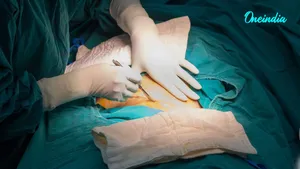 More Than 25% Of Babies In India Now Born Through C-Sections; Private Hospitals Cross 50%, Telangana Tops