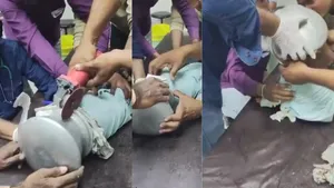 Jalgaon Child Rescue Video: बर्तन में फंसी बच्चे की गर्दन, फिर डॉक्टर ने किया कुछ ऐसा कि सब दंग रह गए