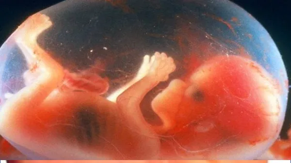Baby Born 30 year Old: सबसे बुजुर्ग नवजात, जानें कैसे हुआ ये अजूबा