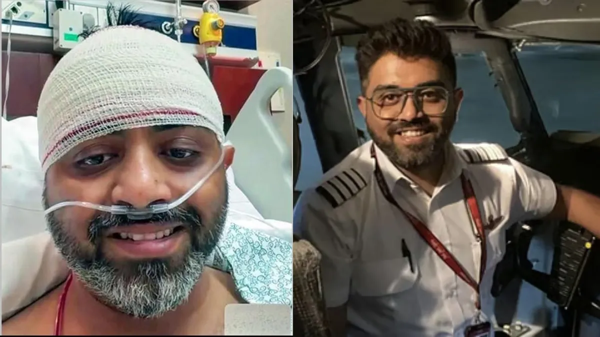 180 பேரை காப்பாற்றிய.. இந்திய பைலட்டின் மூளை பாதிக்க வாய்ப்பு.. இரண்டாக பிளந்த மண்டையோடு.. அவசர ஆபரேஷன்